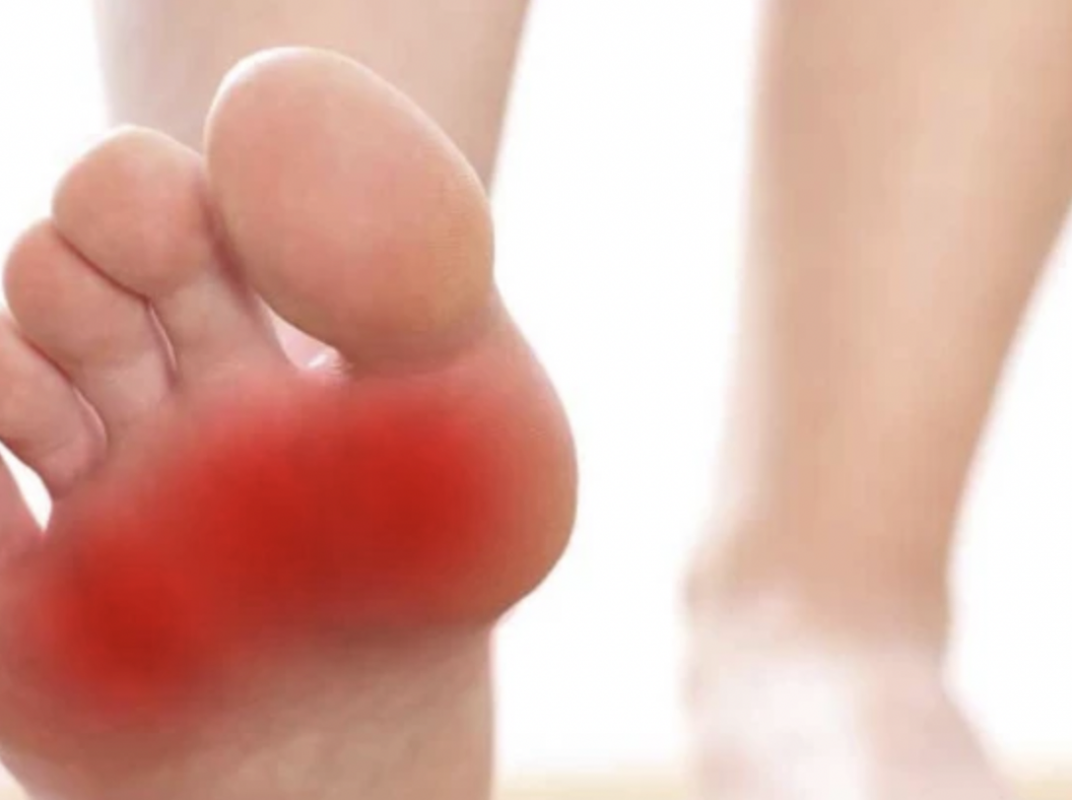 Treating Metatarsalgia With Shockwave Therapy Treating Metatarsalgia With Shockwave Therapy