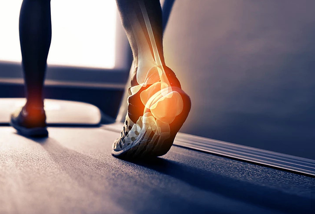 How Shockwave Therapy Can Help With Plantar Faciitis