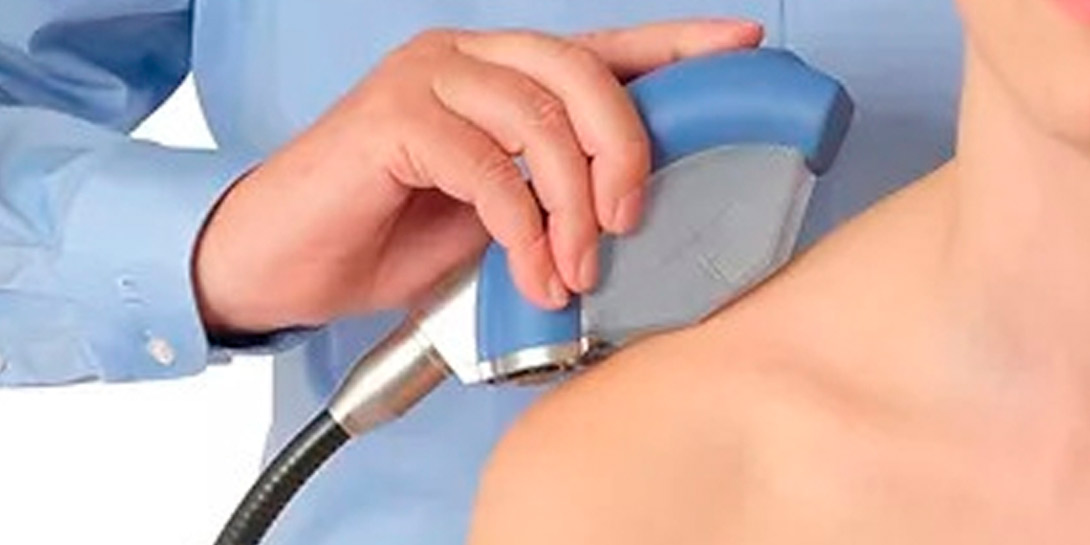 Doctor applies shock wave therapy with special medical equipment on men's back at medical office, close-up view. Concept of non-invasive technology for treating pain in the musculoskeletal system
